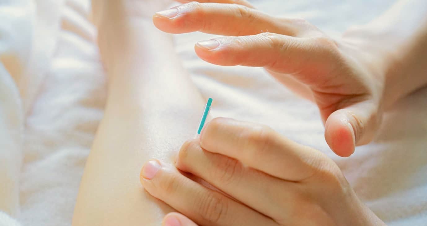 メキシコでも安心の日本の鍼治療と施術